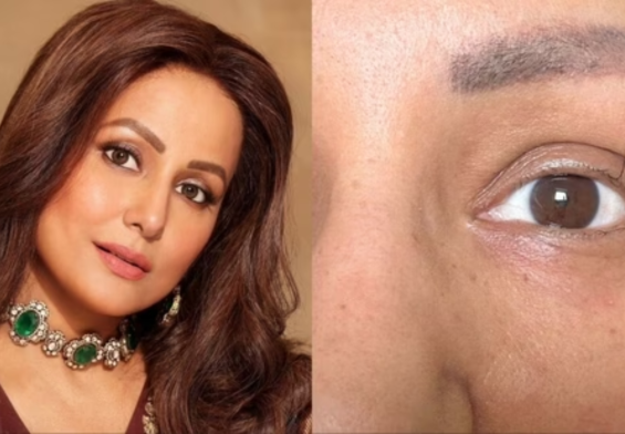 हिना खान की आँखों में बची सिर्फ एक पलक: कैंसर से जंग के बीच दिल दहला देने वाला खुलासा